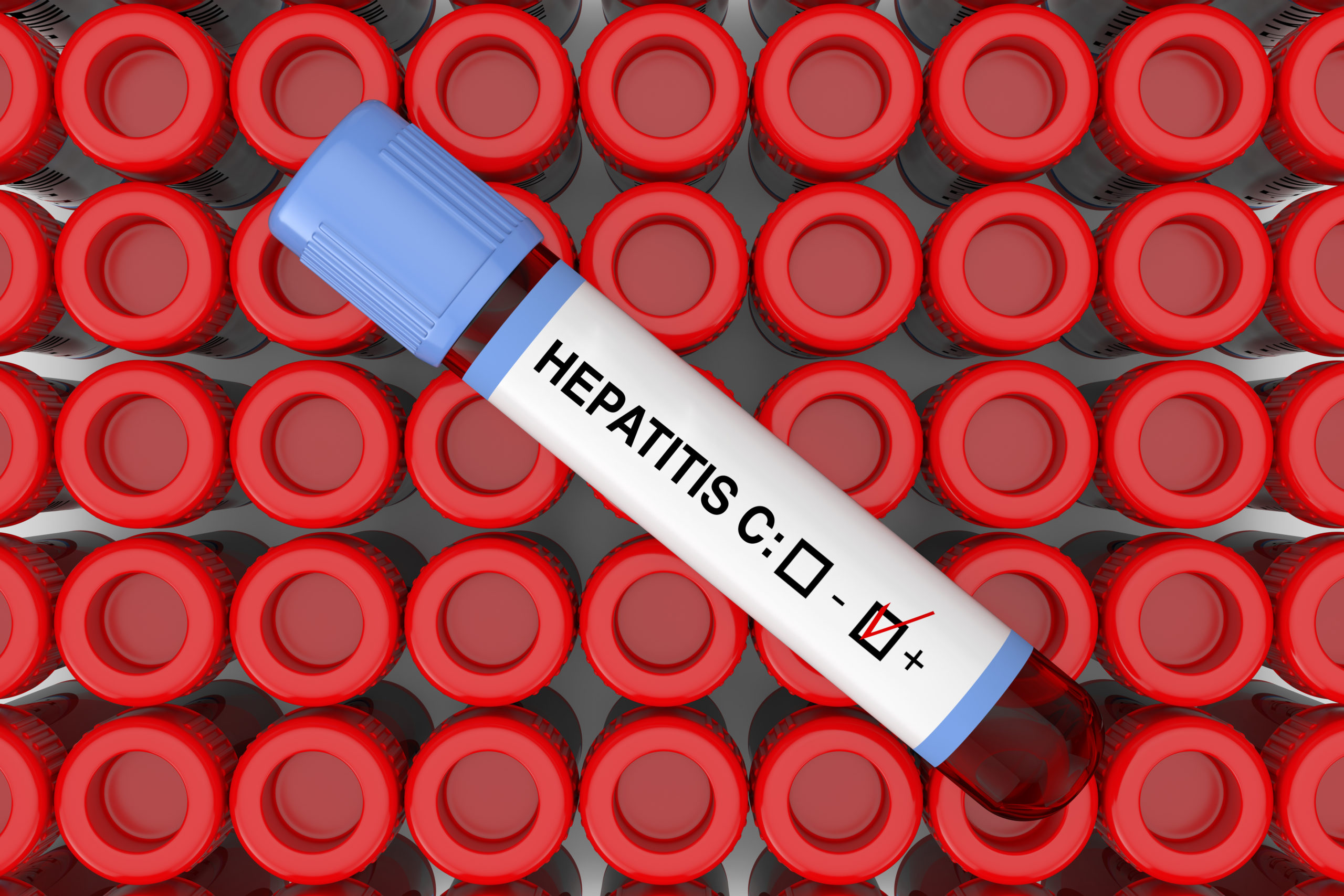 Here's how your hepatitis plasma donation plays a key role in saving lives | AccessClinical